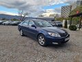 <div style='margin-bottom: 5px; font-size: 14px; color: #000000;'><div style='float: left;'><b>Toyota</b> Camry</div><div style='float: right;'>7 999<div style='text-align: right; font-size: 12px; font-weight: normal;'>ЛЕВА</div></div><div style='clear: both;'></div></div><img src=//vsichkikoli.com/img/obiavi/2025-10-25/car-65bcdf11c9ca94719341e30d28b480dc.jpg>